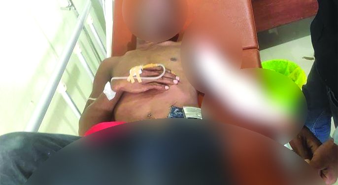 Tersengat Listrik, Luka Bakar 12 Persen