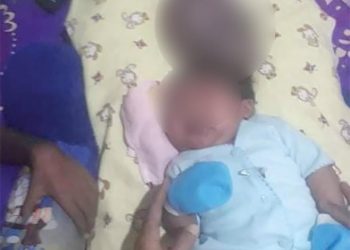 Bayi Haikal Bakal Dirujuk ke Jogja