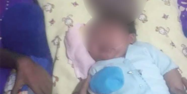 Bayi Haikal Bakal Dirujuk ke Jogja