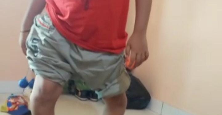 Pj. Gubenur PB Rogoh Puluhan Juta Bantu Anak Difabel
