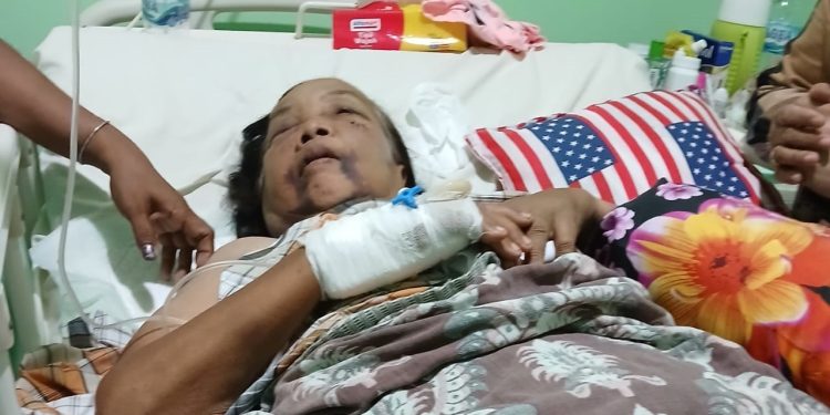 Isnaini, Korban Kekerasan dan Pemerkosaan di Km 8 Meninggal Dunia, Kapolres Minta Pelaku Menyerahkan Diri