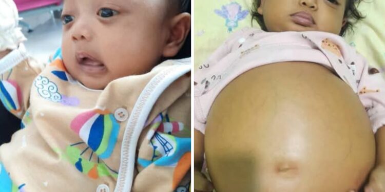Naura, Anak Warga Teminabuan Butuh Bantuan