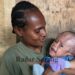 Bayi Penderita Hidrosefalus & Jantung Bocor di Sorong Butuh Biaya Pengobatan